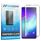 Mobigear Premium Samsung Galaxy S10 5G Glazen Screenprotector - Case Friendly - Zwart
