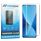 Mobigear Premium Xiaomi 12X Glazen Screenprotector - Case Friendly - Zwart